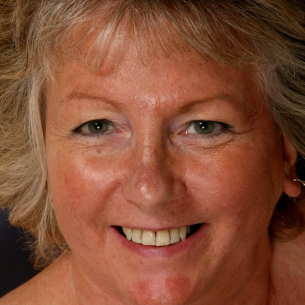                     Mieke                